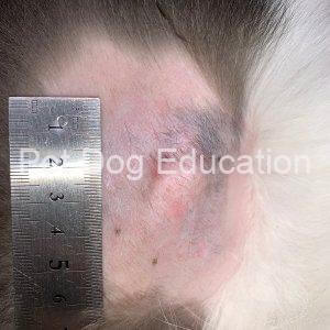 bedsores Left shoulder 20181006