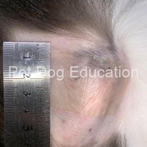 bedsores Left shoulder 20181006