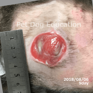 bedsores_20180806_9_k