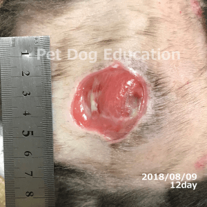 bedsores_20180809_12_k