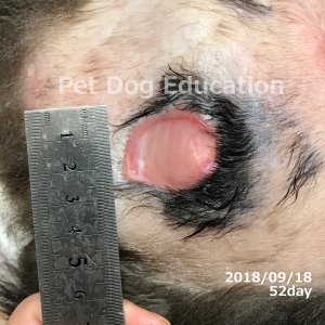 bedsores_20180918_52_k