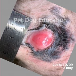 bedsores_20181010_73_k