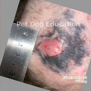 bedsores_20181016_79_k