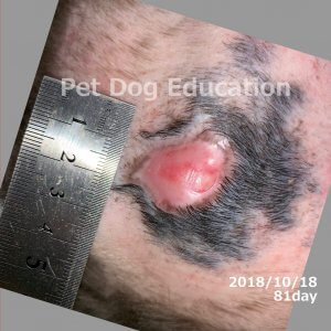 bedsores_20181018_81_k